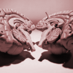 split brain_edited-1